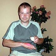 Ich leide seit 20 Jahren an schwerer Psoriasis .... Ursprünglich hatte ich es mir probeweise ausgeliehen, um einen guten Freund nicht zu beleidigen, der mir diese Möglichkeit botund in der Überzeugung, dass ich es in Ruhe zurückgeben würde, denn wie andere Methoden, die ich ausprobiert hatte, würde es mir wahrscheinlich nichts nützen. Aber das tat ich nicht! Im Gegenteil, ich habe es gerne bezahlt und seine großartigen Fähigkeiten mit Erstaunen weiter genutzt.